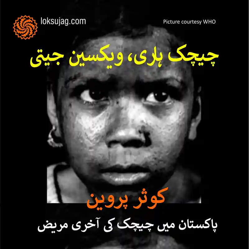 چیچک ہار گئی، ویکسین جیت گئی